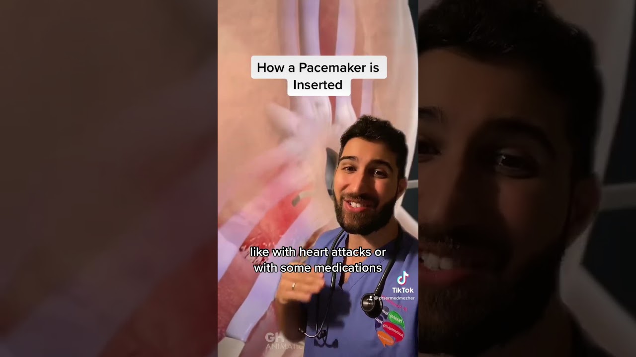 How a Pacemaker is Inserted #heartblock