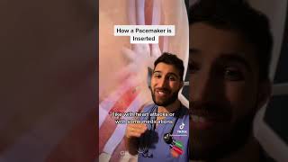 How a Pacemaker is Inserted #heartblock