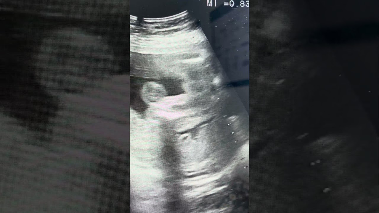 Michelle Melgarejo Quintana-10