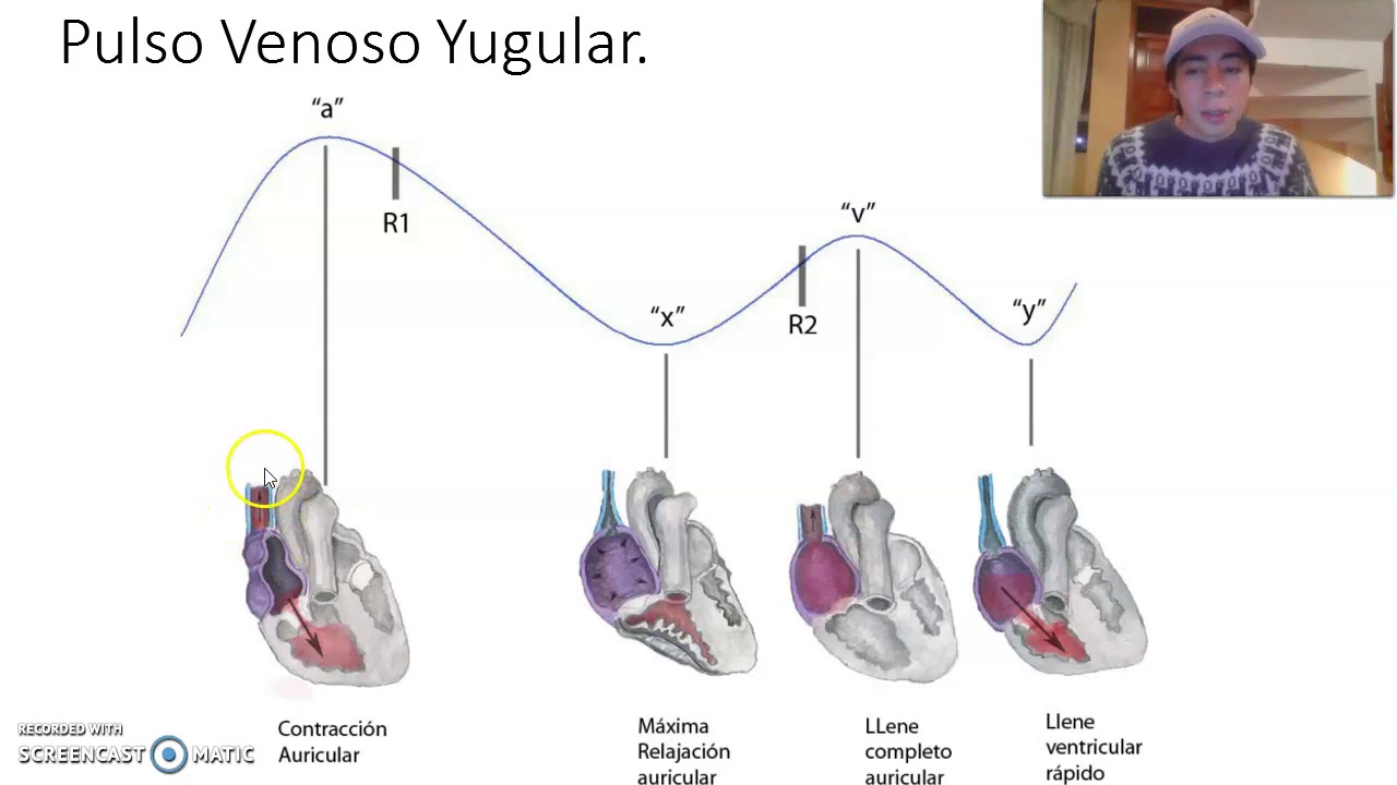 Pulso Venoso Yugular