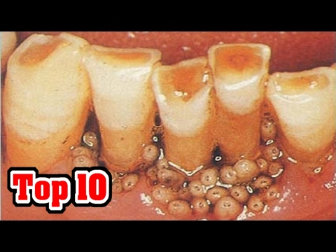 Top 10 STRANGE Medical Conditions