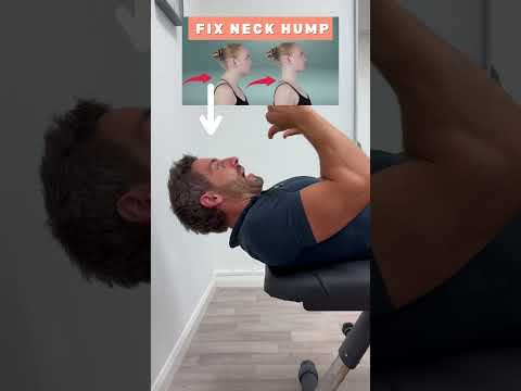 Here is how to fix neck hump. #neckhump #posture