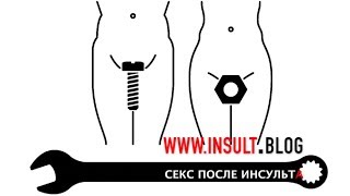 Секс после инсульта. Часть 1.