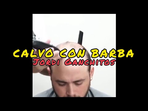 JORDI GANCHITOS - CALVO CON BARBA