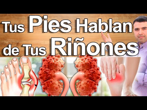 Los Pies Pueden Indicar Que Tus Riñones Están Enfermos