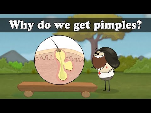 Why do we get pimples? | #aumsum