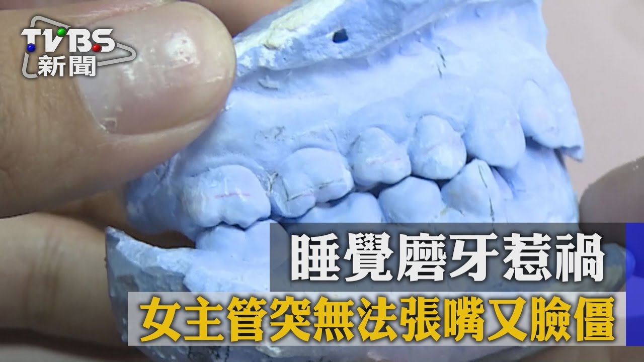 女主管突無法張嘴又臉僵 睡覺磨牙惹禍