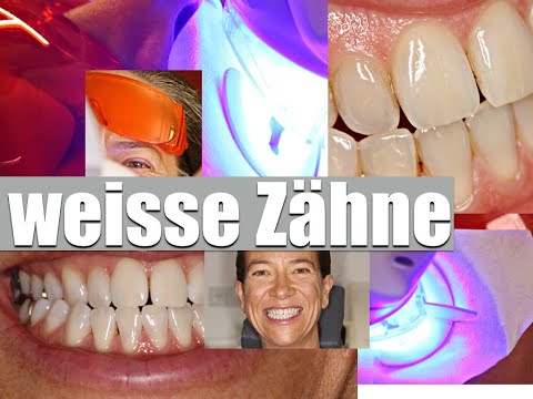 WEISSERE ZÄHNE: schadet BLEACHING meinen Zähnen? wie geht das? TIPPs vom ZAHNARZT