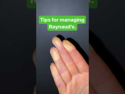 Tips for managing Raynaud's.
