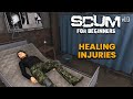 HEALING INJURIES!! - SCUM for Beginners