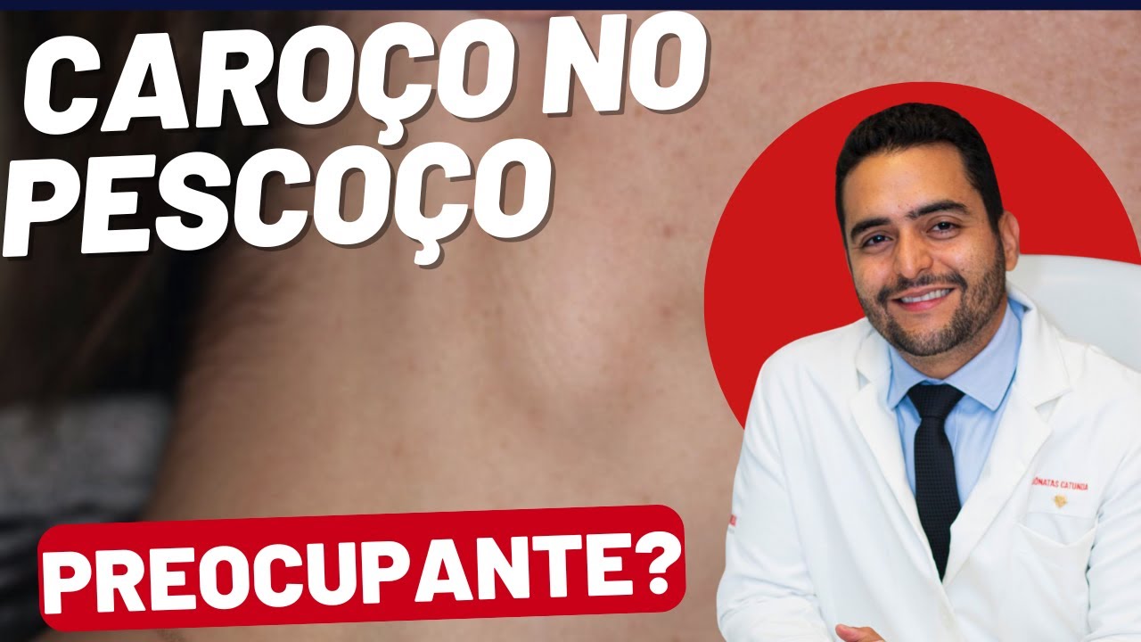 Caroço no Pescoço: Quando se Preocupar e o Que Fazer - Tire Suas Dúvidas!