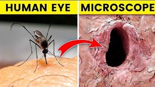 माइक्रोस्कोप से इन चीज़ो को देखकर होश उड़ जायेंगे Things You Can Only See Under Microscope