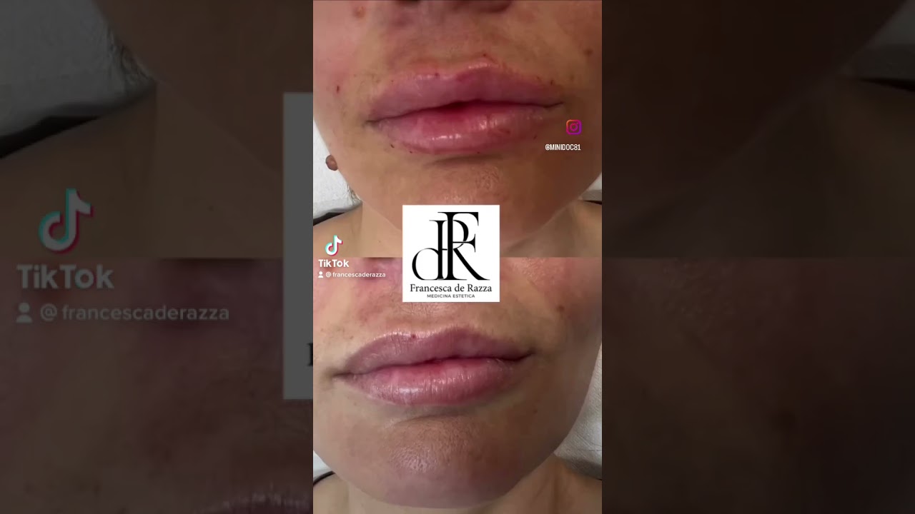 Francesca De Razza-89