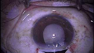 Farhan First Extracap