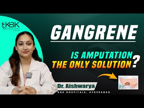 Gangrene Types and Symptoms | The Best Treatment for Gangrene Without Amputation | KBK Hospitals