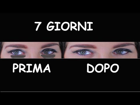 Che faccia la crema di decolorazione è dannosa Ricette di decolorazione di pelle nel posto intimo