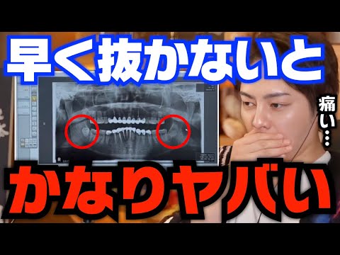 【青汁王子】放置していると●●の原因になります。抜いてない人はいち早く抜きましょう【青汁王子 切り抜き 三崎優太 親知らず 歯医者 口腔外科】
