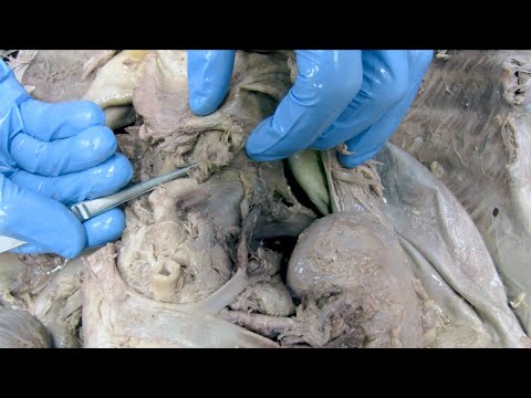 2 Fragen 1 Organ - Ösophagus