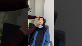 Burun estetiği sonrası silikon tampon çıkartılması #rhinoplasty#silico