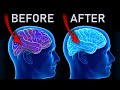 LISTEN BEFORE BED To Calm Your Busy Brain MELATONIN Inducing Theta Waves 4Hz Sleep Remedy