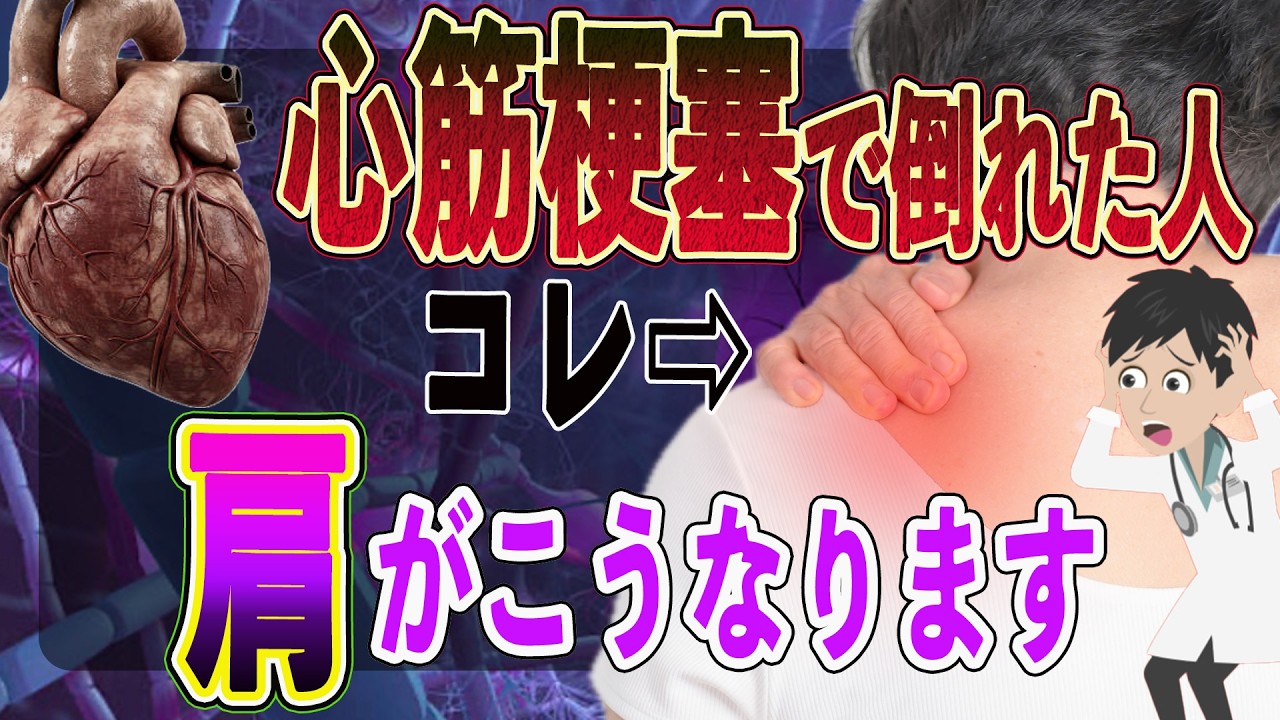 【要注意】絶対知ってほしい！心筋梗塞で倒れた人の“見逃されがちな意外な症状”5選｜胸が痛くないケース