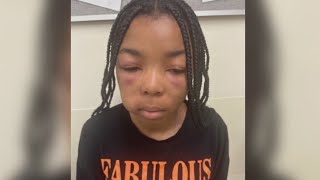 Teen Girl Assaulted at Los Angeles McDonald’s, Family Seeks Justice Teen Girl Assaulted at Los Angeles McDonald’s, Family Seeks Justice