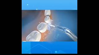 Beautyronics - USB Rechargeable Water Flosser with Interchangeable Toothbrush Head