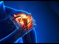 Shoulder Stem Cell Treatment with Dr. Mark Wagner