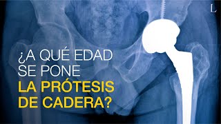 ¿A qué edad se ponen las prótesis de cadera ¿Soy muy joven para llevarla