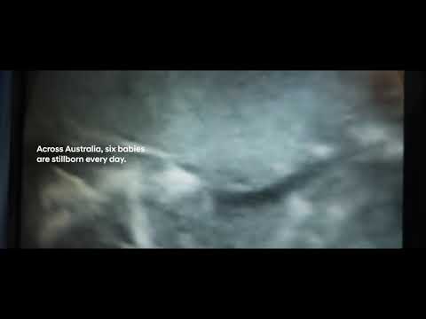 Sleep on your side: Reduce the risk of stillbirth