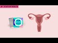 Opill Over The Counter Birth Control Pill
