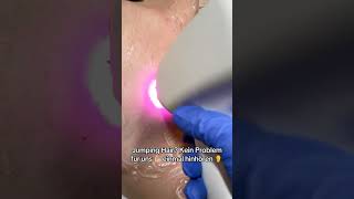 Hair treatment #trending #girl  #shortvideo #shorts #treatment