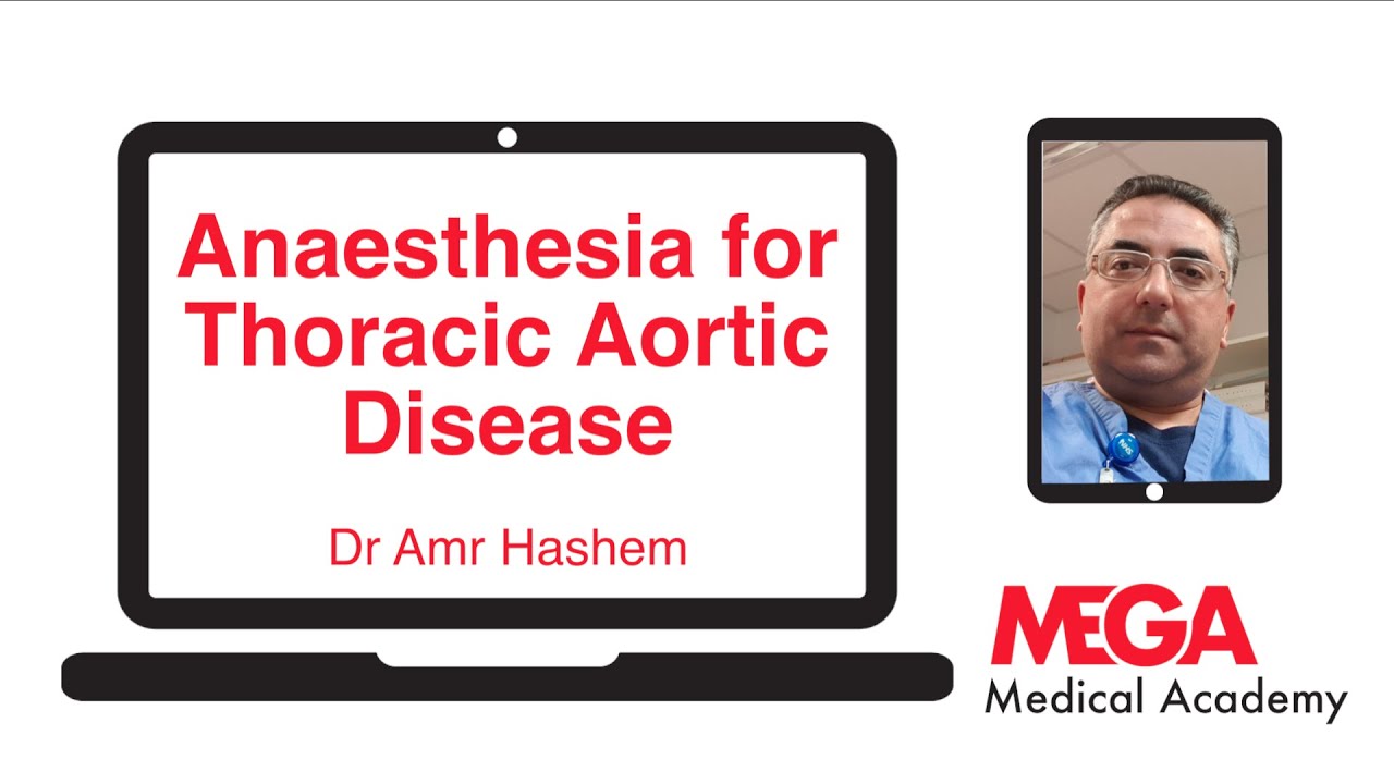 Anaesthesia for Thoracic Aortic Disease