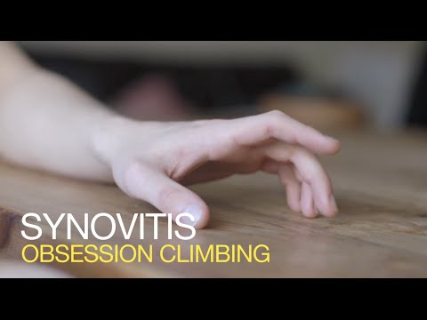 synovitis bokakezelés áttekintése