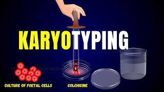 KARYOTYPING - HUMAN GENETICS