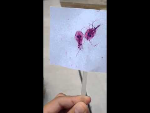 giardia insomnia hogyan lehet férgek kezelésére felnőtt tablettát