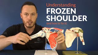 Understanding FROZEN SHOULDER and how to stretch f