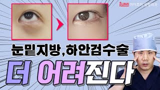 더 어려지는 #하안검  #눈밑지방재배치 차이점!