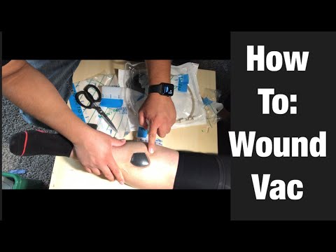 How To Perform Wound Vac Dressing Change