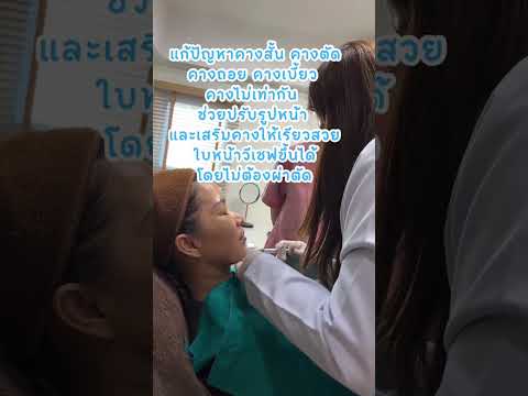 รีวิวหัตถการโปรแกรมฟิลเลอร์คาง