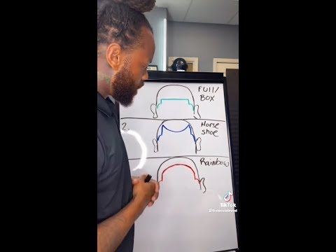 What type of hairline do you have ?