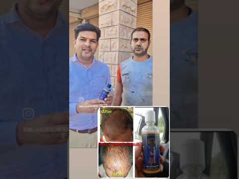 Hair Regrowth Treatment Service