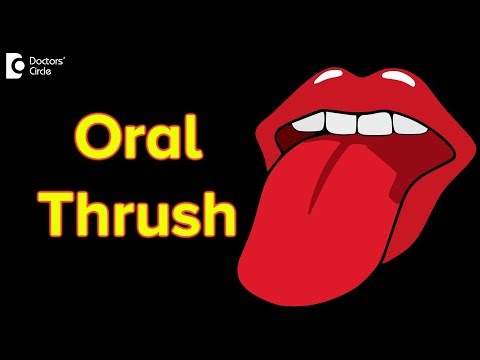 Oral thrush: Causes, Symptoms, Treatment | Oral thrush contagious