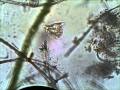 Vorticella At 400X Taken With Tucsen Microscope Camera Using MICAM With Xvid Compression