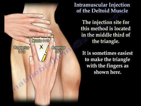 Injection intramusculaire deltoïde