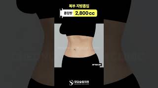 뱃살 빼는 방법, 어렵지 않죠?