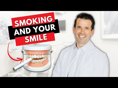 1st YouTube video about how can dentist tell you vape