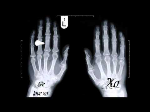 Flyboy Ysl - Drop Squad Song