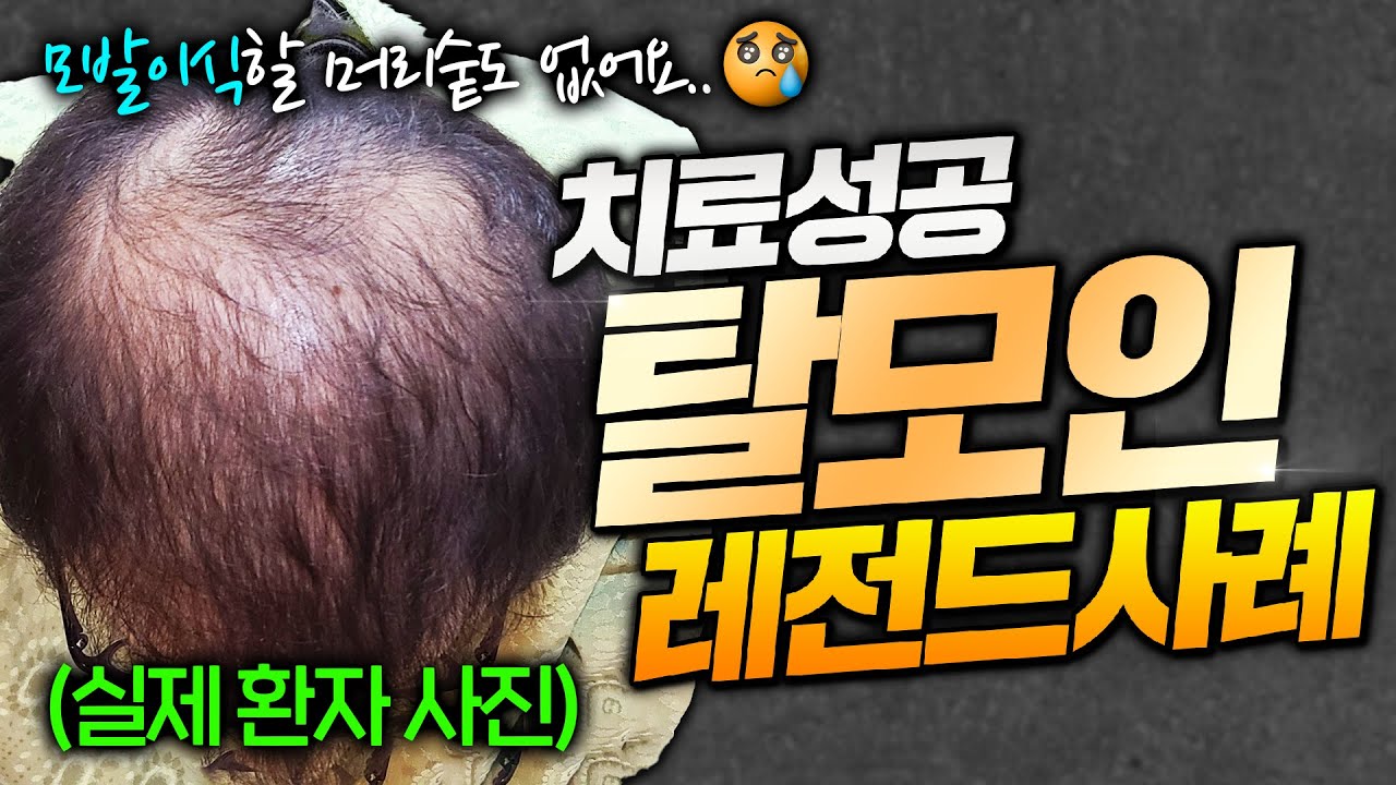 더원츠의원 유튜브