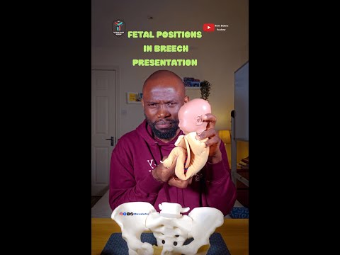 How to DETERMINE Fetal Positions in Breech Presentation